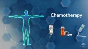Chemotherapy