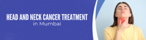 Head_And_Neck_Cancer_Treatment