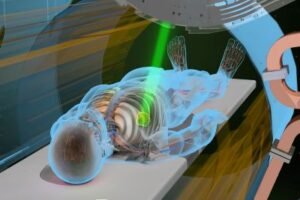 Radiation Therapy