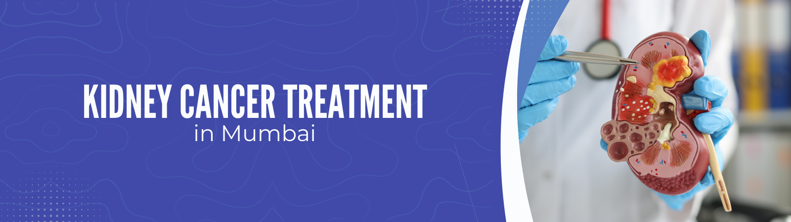 Kidney Cancer treatment