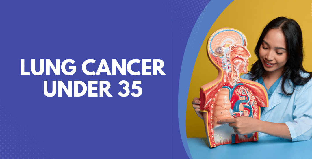 Lung Cancer Under 35