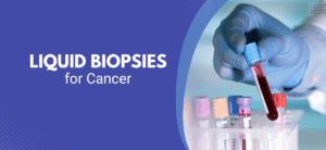 Liquid Biopsies