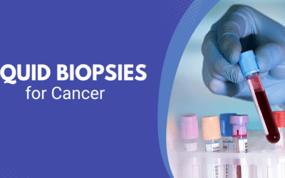 Liquid Biopsies for Cancer: A Non-Invasive Approach to Cancer Monitoring