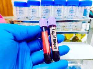 liquid-biopsy